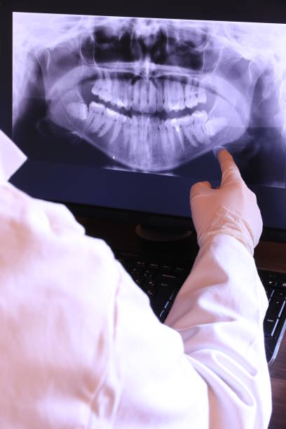 Best Emergency Gum Treatment in Kirksville, MO