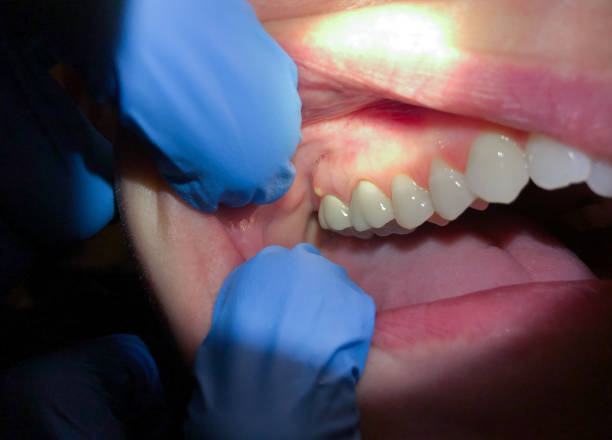 Best Cosmetic Emergency Dentistry in Kirksville, MO