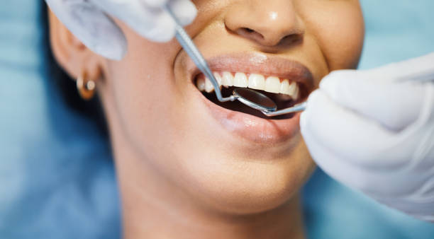Best Emergency Dental Care for Broken or Chipped Teeth in Kirksville, MO